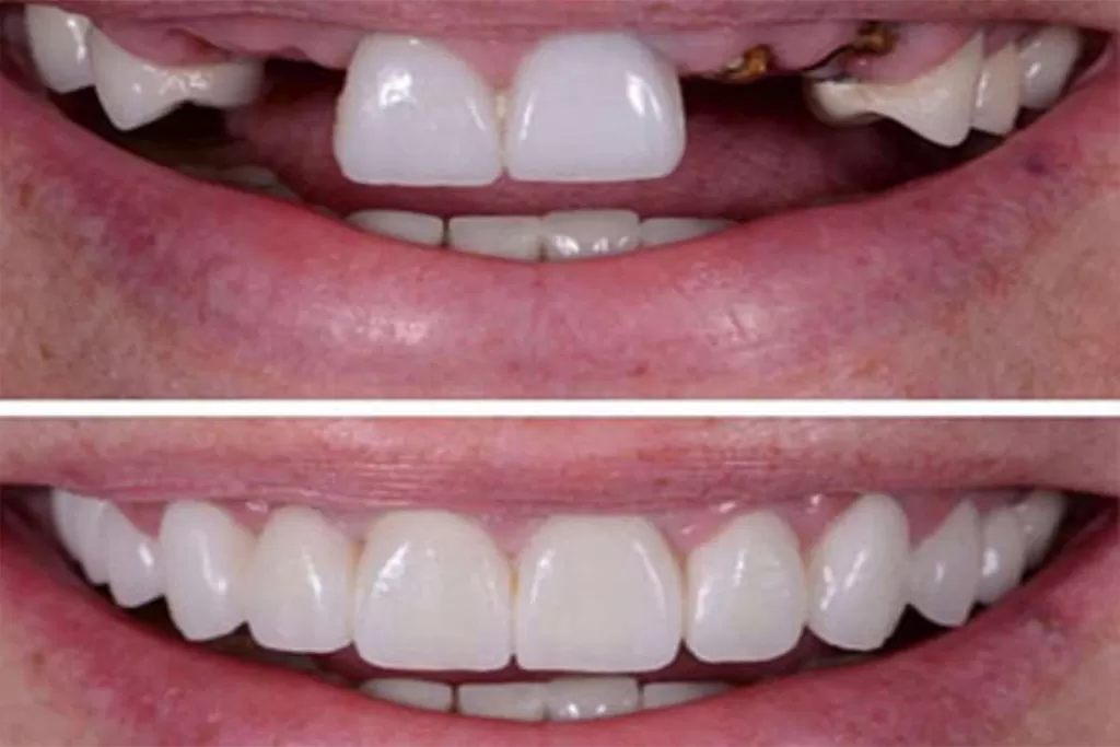 Orthopedics Services